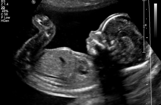ultrasound image
